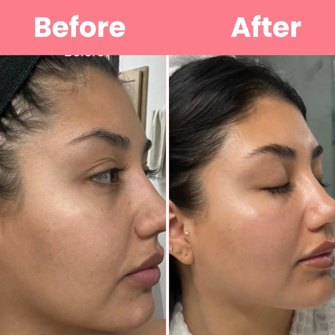 HOYGI™ – Masque au collagène à retirer en une seule pièce