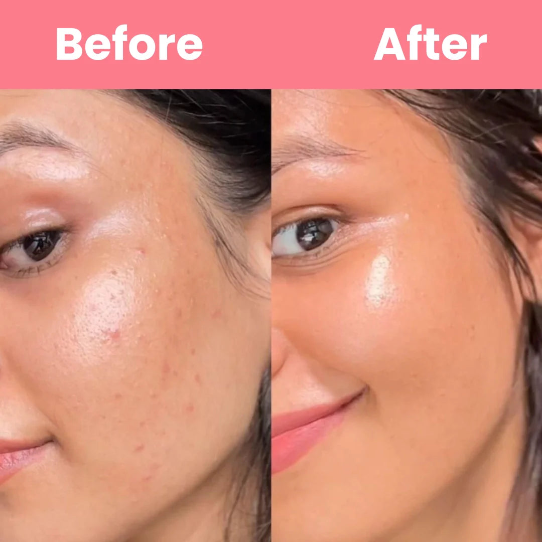 HOYGI™ – Masque au collagène à retirer en une seule pièce