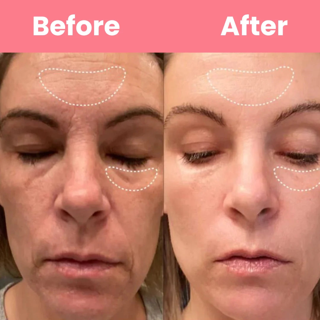 HOYGI™ – Masque au collagène à retirer en une seule pièce