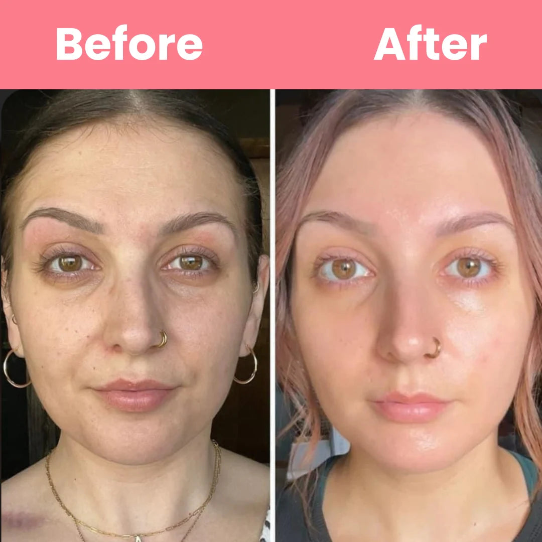 HOYGI™ – Masque au collagène à retirer en une seule pièce