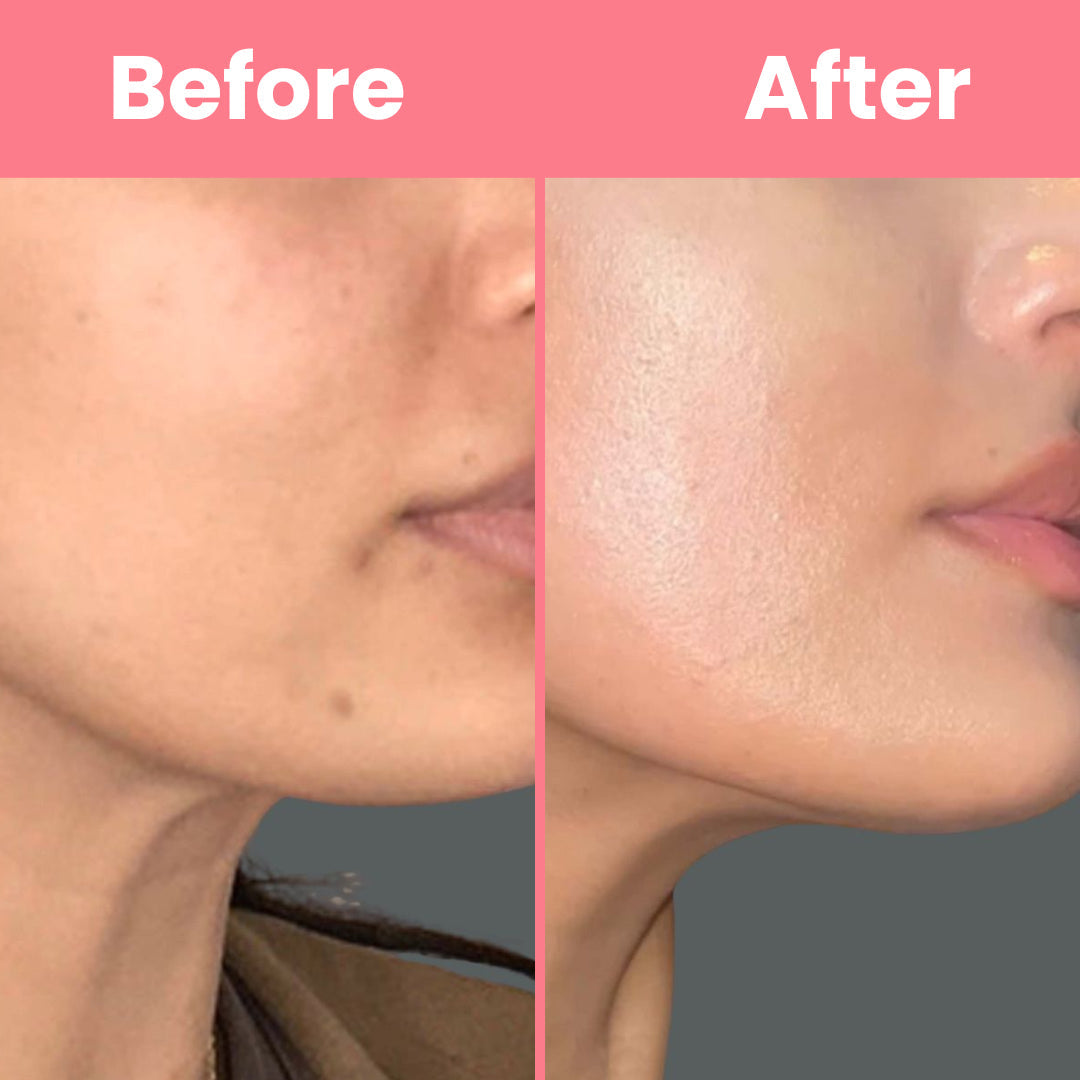 HOYGI™ – Masque au collagène à retirer en une seule pièce